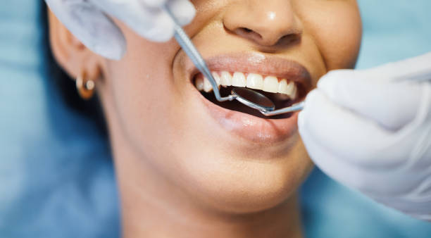 Best Urgent Care for Lost Fillings or Crowns in Old Greenwich, CT