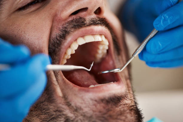 Best Emergency Root Canal Treatment in Old Greenwich, CT